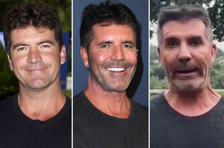 Learn About Simon Cowell's Baffling Illness And Recent Health Concerns
