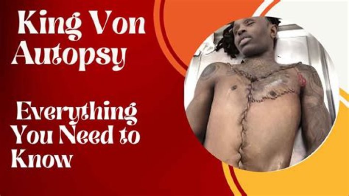 Unraveling The Mystery: The King Vin Autopsy